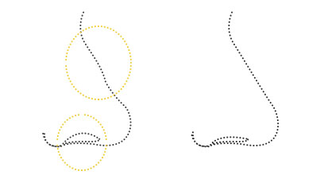 Illustration for article titled Nose Reshaping/Rhinoplasty